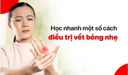 Học nhanh một số cách điều trị vết bỏng nhẹ tại nhà