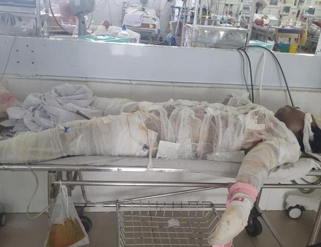 Ninh Thuận: Cha dùng xăng đốt nhà khiến con ruột tử vong trong phòng ngủ