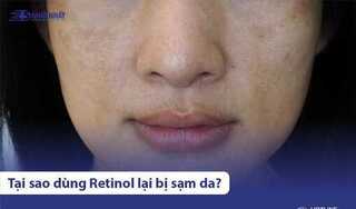 Tại sao dùng retinol bị sạm da? Phải làm sao để khắc phục?