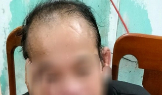 Bắt giữ nghi phạm hiếp dâm cụ bà 85 tuổi ở Quảng Trị
