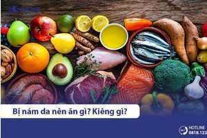 Nám tàn nhang nên ăn gì và kiêng gì? 15 thực phẩm cần chú ý
