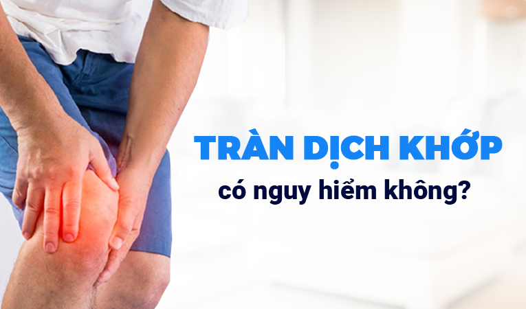 Giải đáp: Tràn dịch khớp có nguy hiểm không?