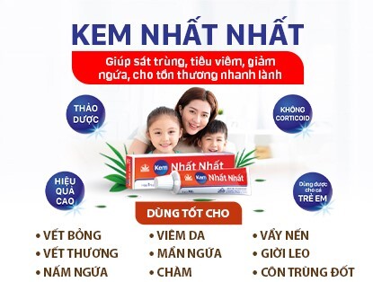 Lý giải nguyên nhân nổi mề đay để điều trị và phòng ngừa đúng cách