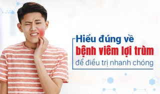 Hiểu đúng về bệnh viêm lợi trùm để điều trị nhanh chóng