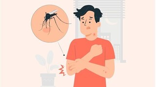 Áp dụng ngay 11 cách phòng chống muỗi đốt hiệu quả