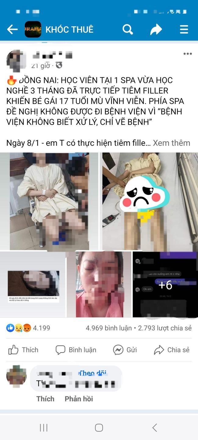 Thiếu nữ 17 tuổi bị mù sau khi tiêm filler ở Đồng Nai: Spa chỉ được cấp phép... cắt tóc, gội đầu