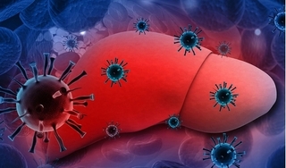 Tìm hiểu về bệnh viêm gan C - kẻ thù tiềm ẩn của gan