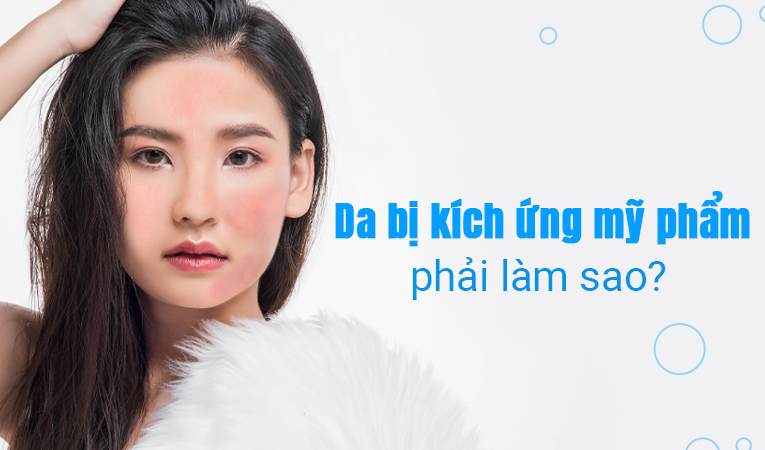 Bạn có biết: Da bị kích ứng mỹ phẩm, phải làm sao?