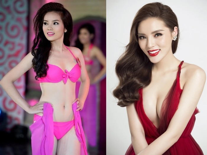 Hoa hậu Đỗ Mỹ Linh gây bất ngờ khi công khai tiêm thẩm mỹ