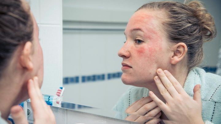Nguyên nhân và cách xử lý dị ứng da mặt an toàn