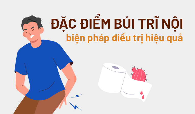 Đặc điểm búi trĩ nội và các biện pháp điều trị hiệu quả