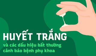 Huyết trắng và các dấu hiệu bất thường cảnh báo bệnh phụ khoa