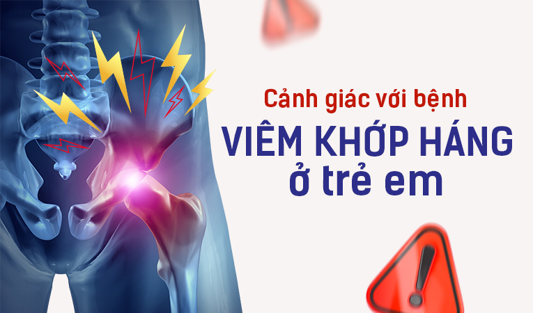 Cảnh giác với bệnh viêm khớp háng ở trẻ em