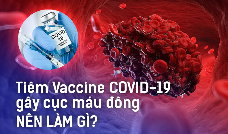 Tiêm vaccine Covid-19 gây cục máu đông: Chúng ta nên làm gì?