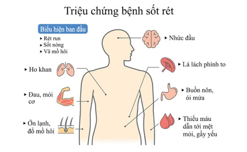 Bệnh sốt rét nguy hiểm: Chỉ dẫn cách phòng tránh đơn giản