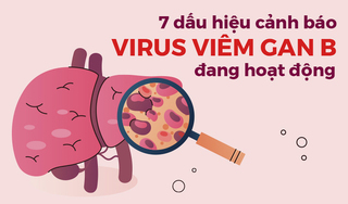 7 dấu hiệu cảnh báo virus viêm gan B đang hoạt động, cần điều trị