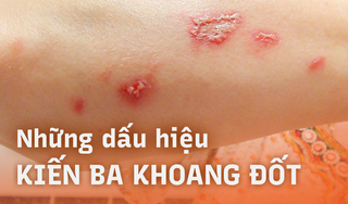 Những dấu hiệu kiến ba khoang đốt dễ nhận biết