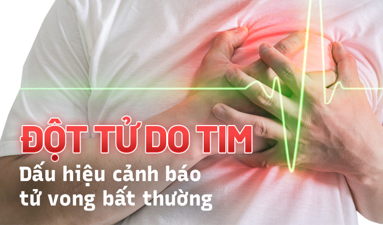 Đột tử do tim: Dấu hiệu cảnh báo tử vong bất thường ở người khỏe mạnh