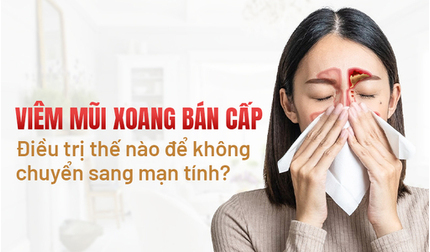 Viêm mũi xoang bán cấp: Điều trị sao để không chuyển sang mạn tính?