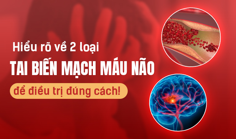 Hiểu rõ về 2 loại tai biến mạch máu não để điều trị đúng cách!