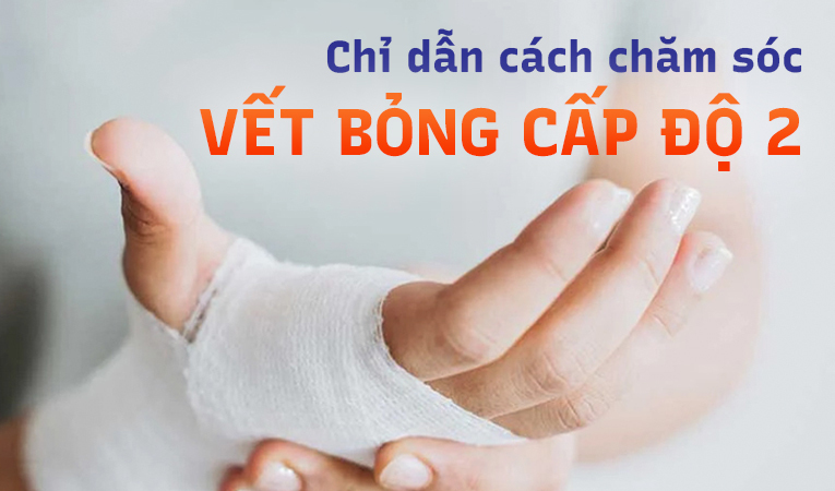 Chỉ dẫn cách chăm sóc vết bỏng cấp độ 2 tại nhà