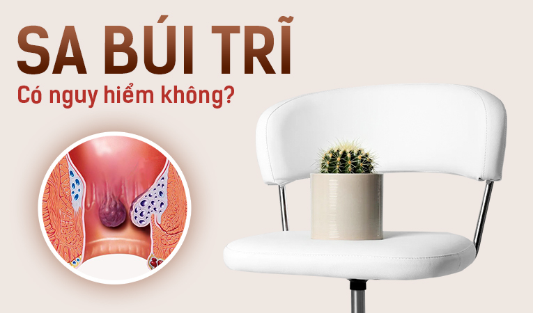 Giải đáp thắc mắc: Sa búi trĩ có nguy hiểm không?