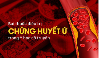 Bài thuốc điều trị chứng huyết ứ trong Y học cổ truyền