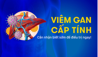 Viêm gan cấp tính: Cần nhận biết sớm để điều trị ngay!