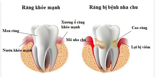 Phòng tránh các bệnh răng miệng cho người lớn tuổi: Không hề khó!