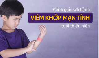 Cảnh giác với bệnh viêm khớp mạn tính tuổi thiếu niên