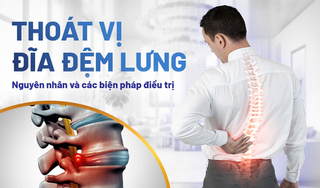 Thoát vị đĩa đệm lưng: Nguyên nhân và các biện pháp điều trị