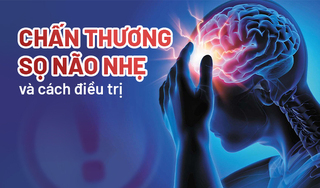 Nhận biết triệu chứng chấn thương sọ não nhẹ và cách điều trị
