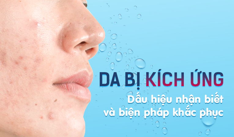 Da bị kích ứng: Dấu hiệu nhận biết và biện pháp khắc phục