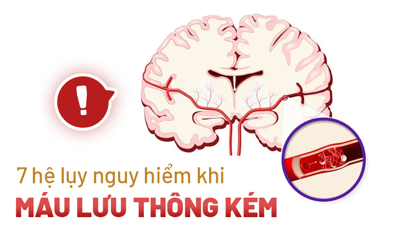 7 hệ lụy nguy hiểm khi máu lưu thông kém