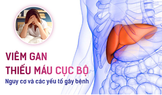 Viêm gan thiếu máu cục bộ: Nguy cơ và các yếu tố gây bệnh