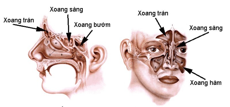 U nhầy xoang trán: Nguyên nhân, triệu chứng và cách điều trị