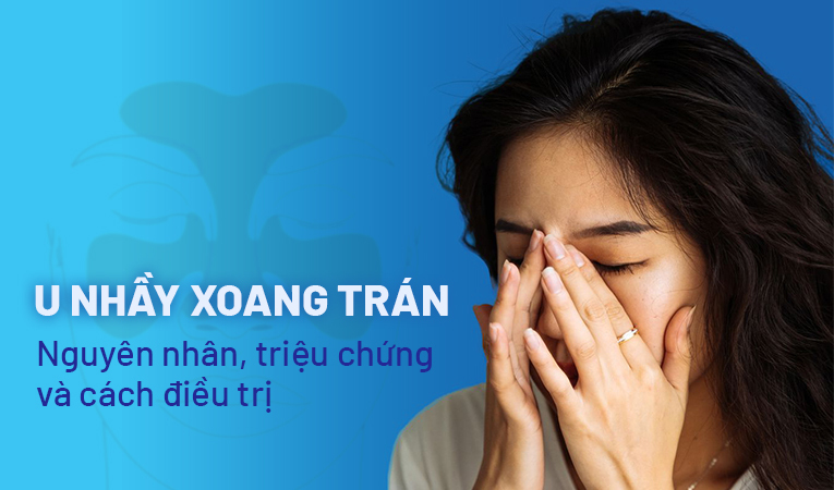 U nhầy xoang trán: Nguyên nhân, triệu chứng và cách điều trị