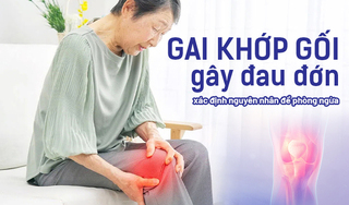 Gai khớp gối gây đau đớn: Cần xác định nguyên nhân để phòng ngừa