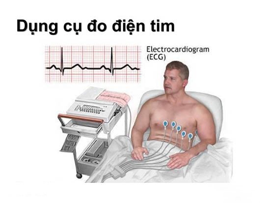 Vì sao cần tầm soát tai biến? Các phương pháp tầm soát tai biến