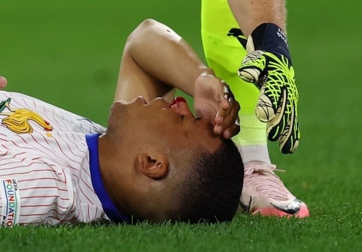 Chùm ảnh: Mbappe gãy xương mũi, phải đeo mặt nạ ở EURO 2024