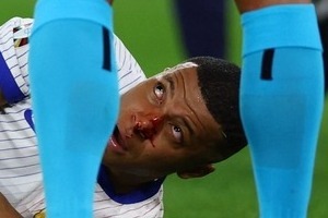Chùm ảnh: Mbappe gãy xương mũi, phải đeo mặt nạ ở EURO 2024