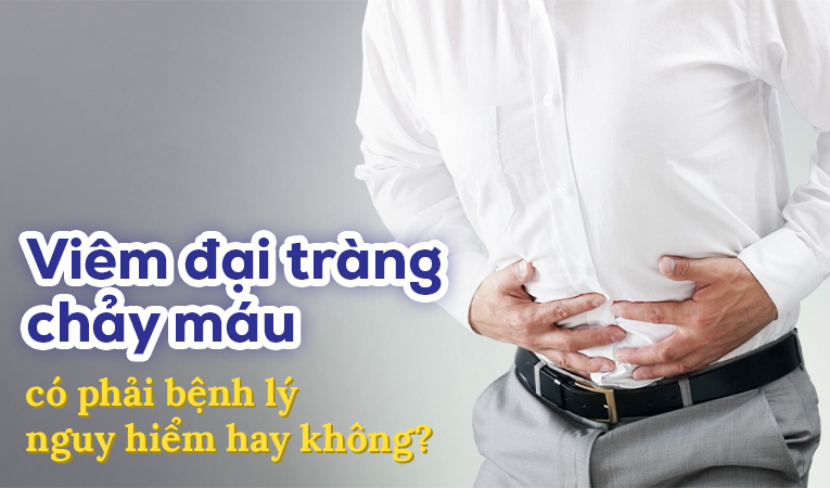 Viêm đại tràng chảy máu có phải bệnh lý nguy hiểm hay không?