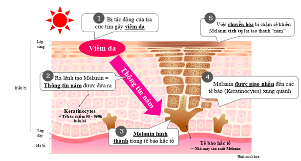 Tổng hợp các cách trị nám da dân gian dễ thực hiện tại nhà