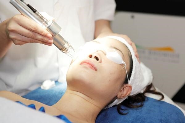 Tổng hợp các cách trị nám da dân gian dễ thực hiện tại nhà