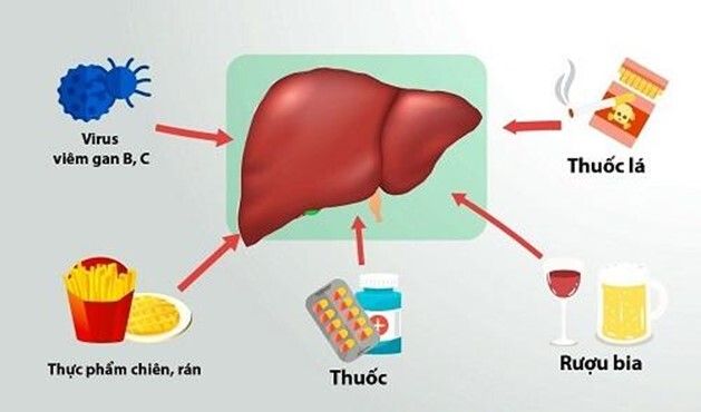 Các bài thuốc Đông y trị viêm gan hiệu quả