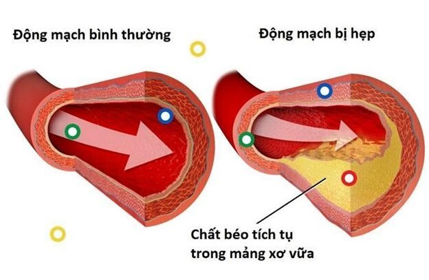 Độ nhớt của máu và ảnh hưởng của nó đối với sức khỏe