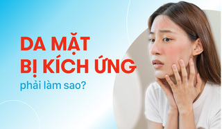Bạn có biết: Da mặt bị kích ứng phải làm sao?