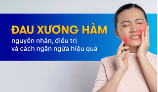 Đau xương hàm: Nguyên nhân, điều trị và cách ngăn ngừa hiệu quả