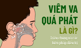 Viêm VA quá phát là gì? Triệu chứng và các biện pháp điều trị