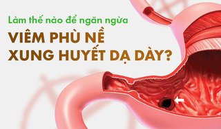 Làm thế nào để ngăn ngừa viêm phù nề xung huyết dạ dày?